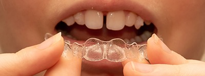 Person with gapped teeth using Invisalign 