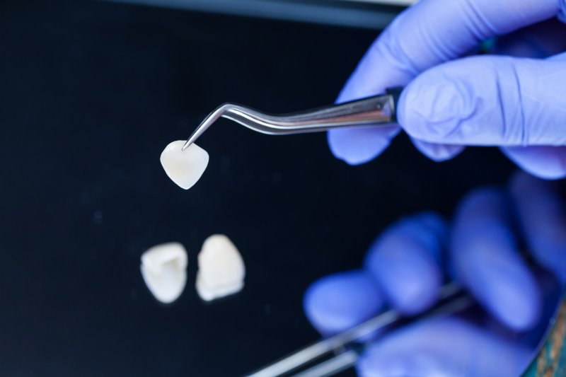 Veneers being held by a tweezer