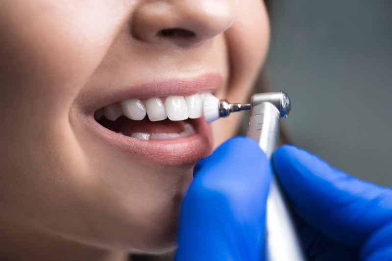 A dentist touching up a patient’s smile after direct bonding